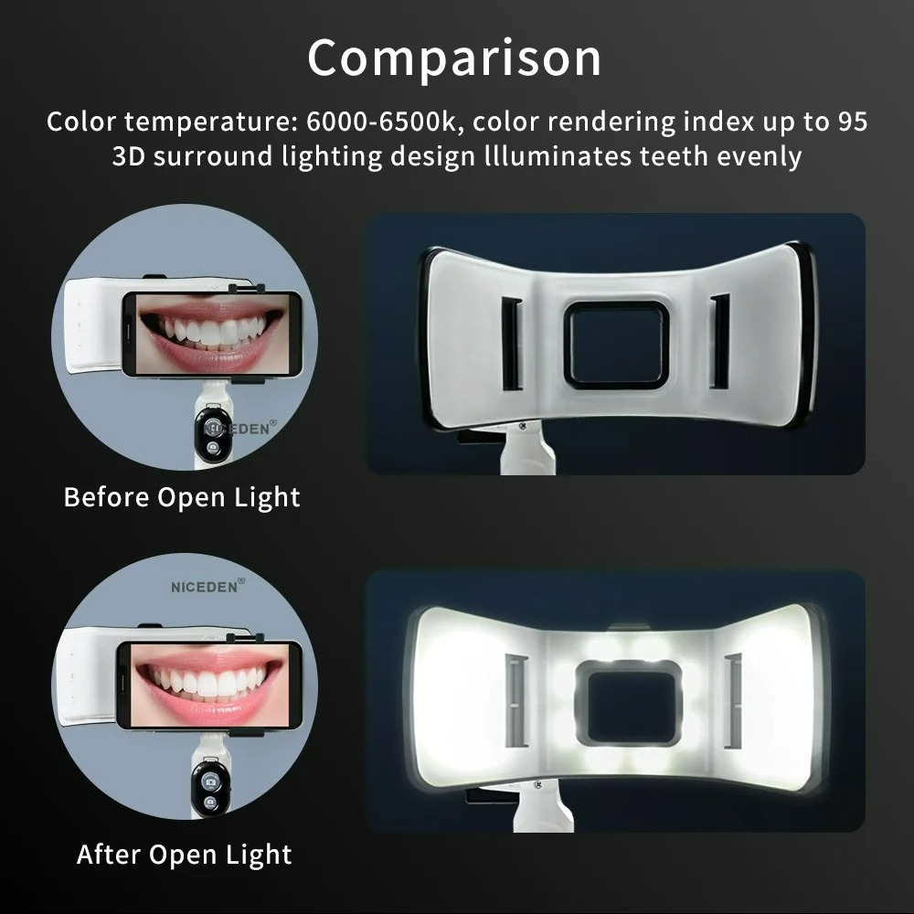 Dental Photography Light Phone - огляд і ціна Photography Dental