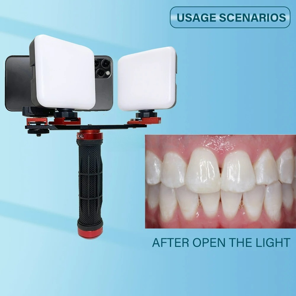 Dental Photography Light Phone - огляд і ціна Photography Dental