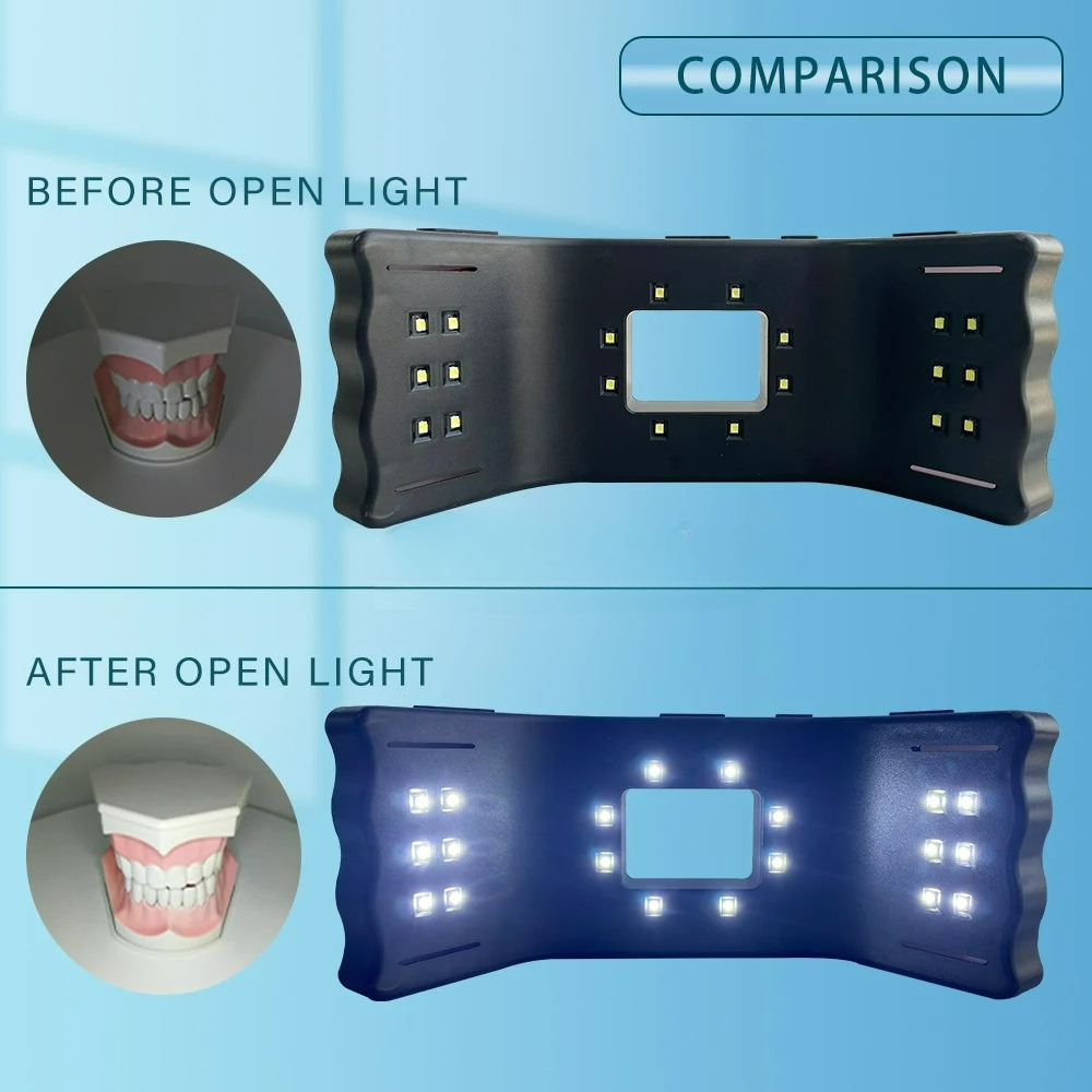 Dental Photography Light Phone - огляд і ціна Photography Dental
